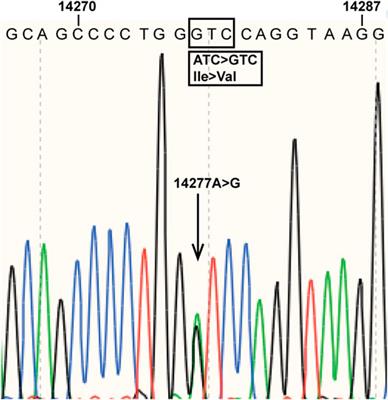 Identification and Enzymatic Activity Evaluation of a Novel CYP2C9 Allelic Variant Discovered in a Patient